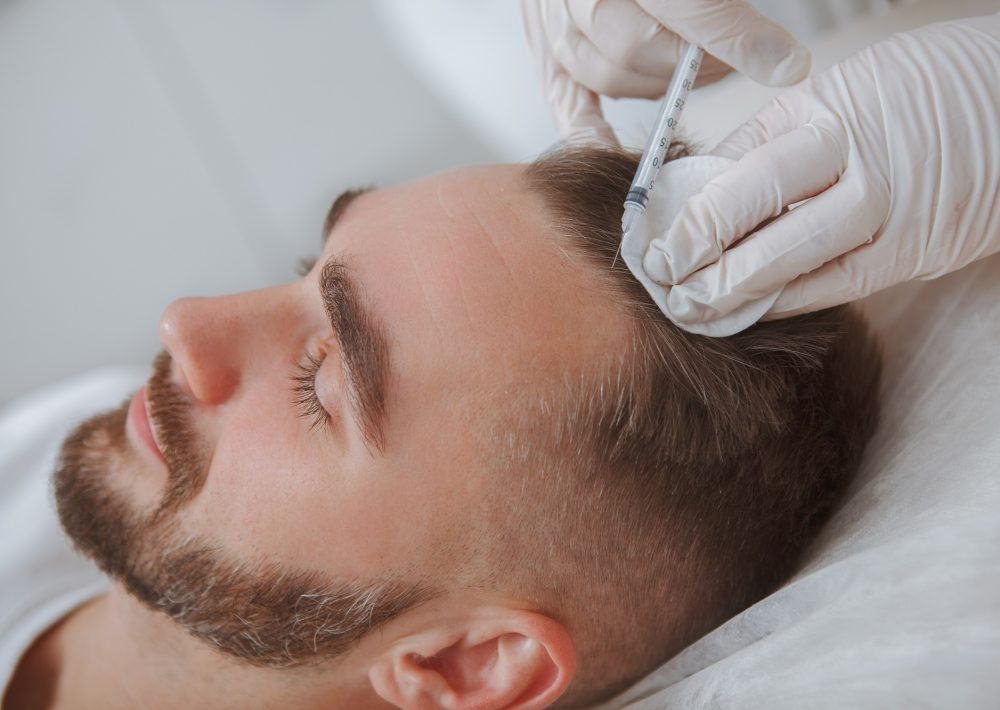 Aesthetician giving hairloss treatment injections into scalp of male client